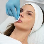 Τι Είναι το Dermal Filler: Όλα Όσα Πρέπει να Γνωρίζετε